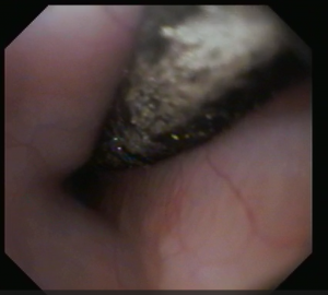 スクリーンショット (1)