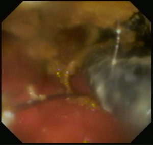 スクリーンショット (2)