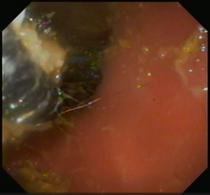 スクリーンショット (4)