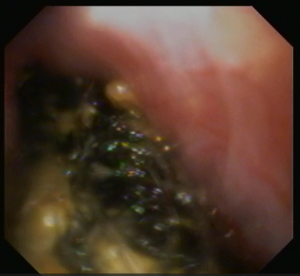 スクリーンショット (5)
