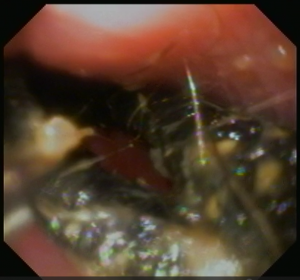 スクリーンショット (6)